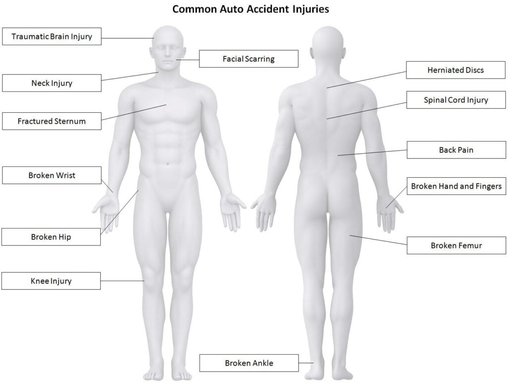 personal injury data leads