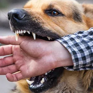 can you get sued if your dog bites someone