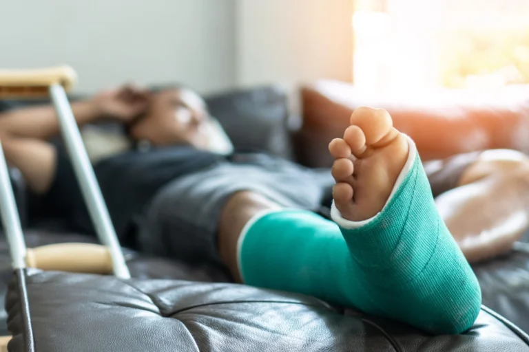 A man lies on a couch with a cast on his foot, appearing calm and at ease.