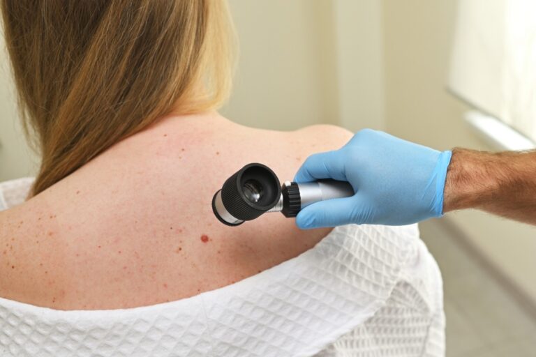 A healthcare professional in blue gloves examines a woman's back with a dermatoscope in a clinical setting. The woman wears a white medical gown.