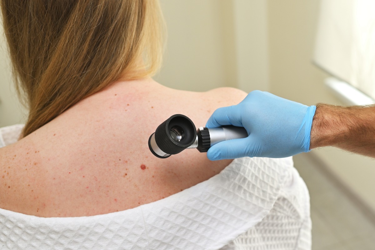 A healthcare professional in blue gloves examines a woman's back with a dermatoscope in a clinical setting. The woman wears a white medical gown.