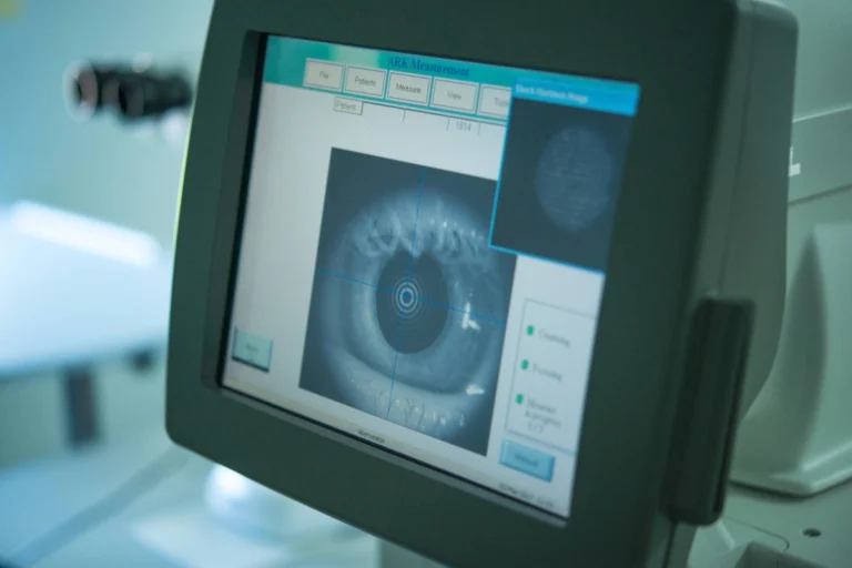 computer monitor of an eye screening exam for vision loss
