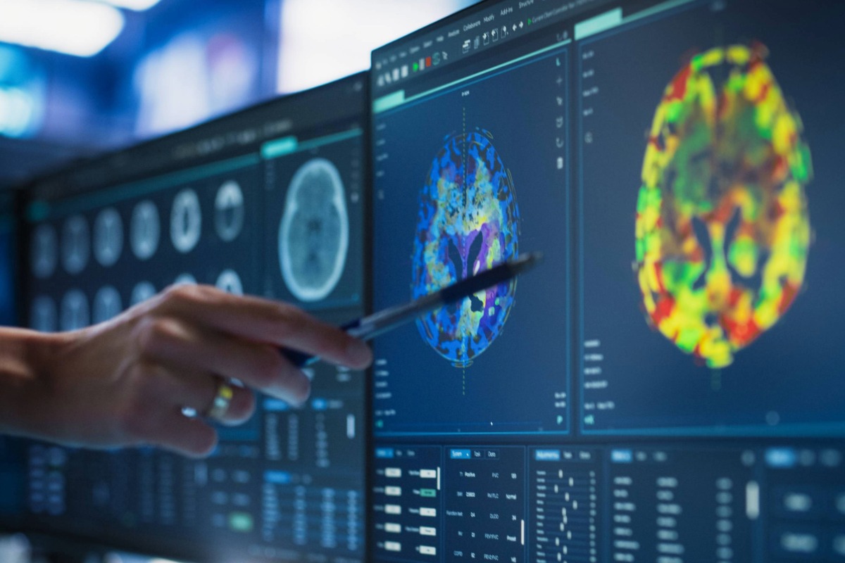 Doctor reviews and MRI scan for Depo-Provera lawsuit claim